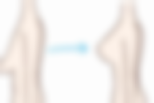 【武汉洪山美吉医院地址:】