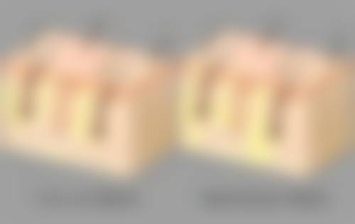 打完瘦脸针正确的睡姿