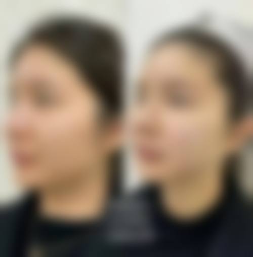 以下是一些患者对成都高新大峰整形医院的正向评价：