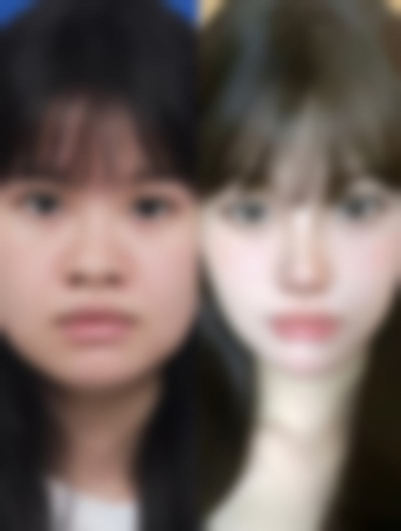 成都高新大峰整形医院提供多种医疗美容项目，涵盖了整形手术、皮肤管理、注射美容等。整形手术方面，可能包括眼部整形、鼻部整形、面部轮廓整形等；皮肤管理项目有激光嫩肤、美白祛斑、祛痘等；注射美容则有玻尿酸注射、肉毒素注射等，能满足不同患者的需求。