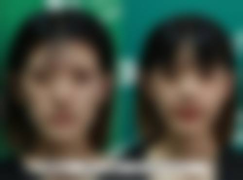 打完瘦脸针后多久可以正常敷面膜