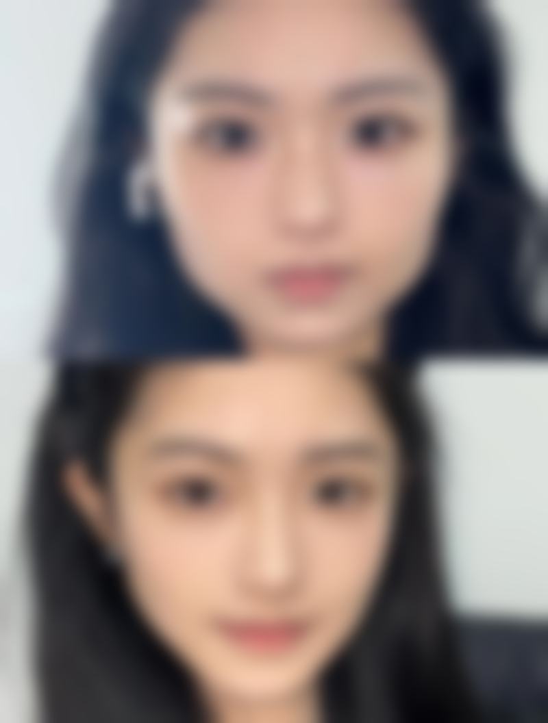 【石家庄臻艾医疗美容诊所参考价格表：】