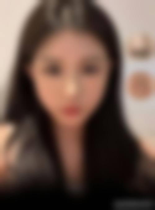 拱墅区熊员平医生面部轮廓整形技术靠谱吗