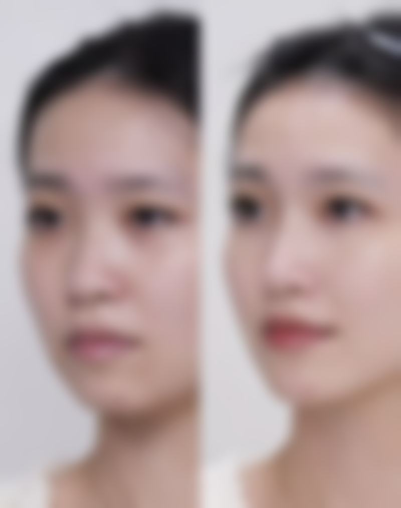 【肥城市中医医院美容科患者口碑评价：】