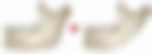 不打瘦脸针能瘦脸吗