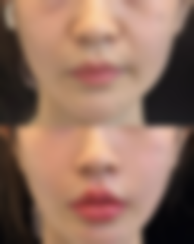 【叶锋医生口碑】