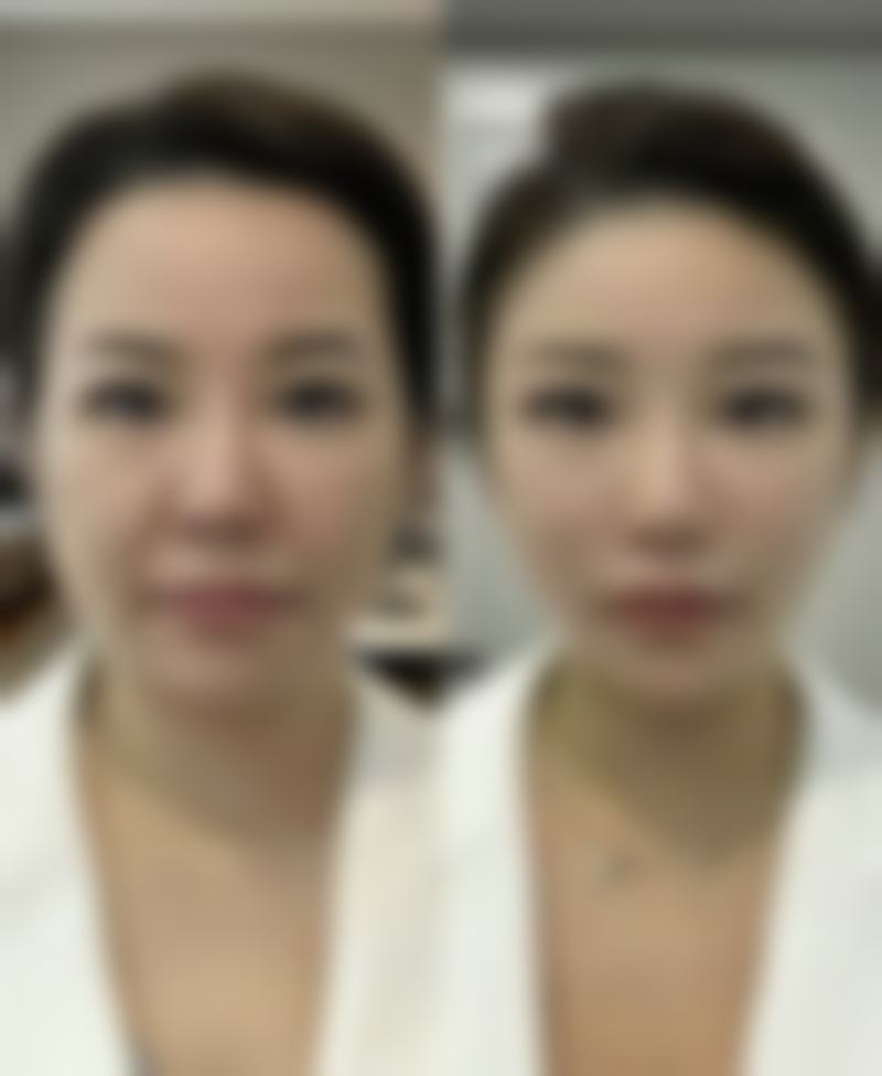 【哈尔滨秀妍汇医疗美容是正规的吗?】