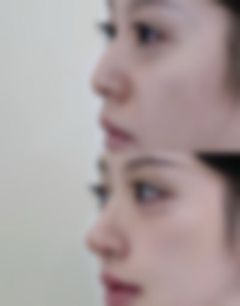 【鄂州市普丽缇莎美容美体会馆特色项目:】