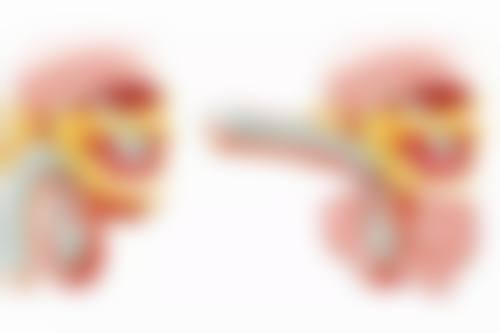 瘦脸针面颊凹陷图片