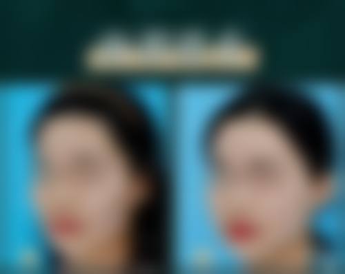 广州高尚医学美容中 心李春明医生技术怎么样