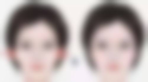 做阴道紧缩术多久能修复？