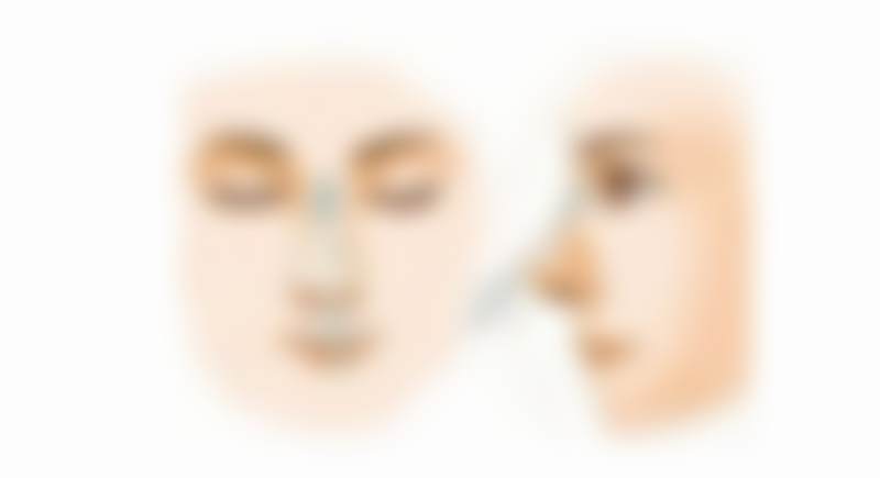 广州高尚医学美容中心李春明是渠道医生吗？权威揭秘！他用20年经验与精湛技术，为超千名顾客打造自然美！ 