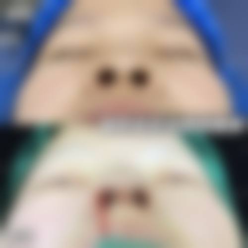 【张代禄医生口碑怎么样？】