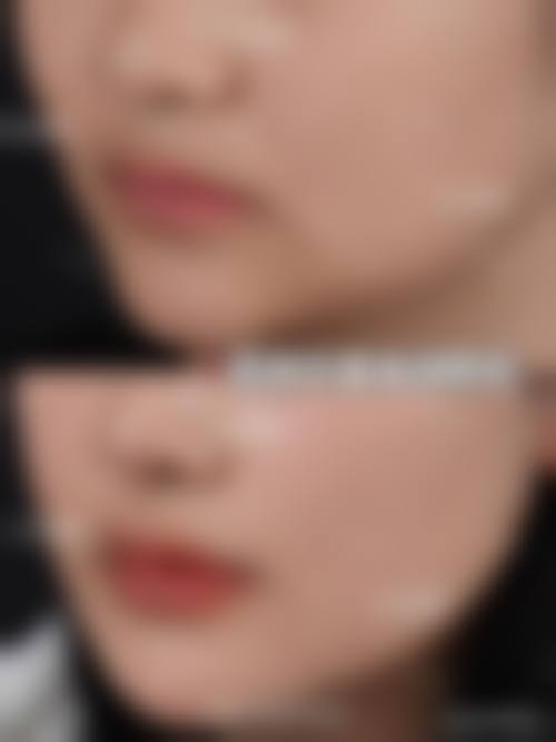 【丽兹美容外科 大阪院参考价格表:】