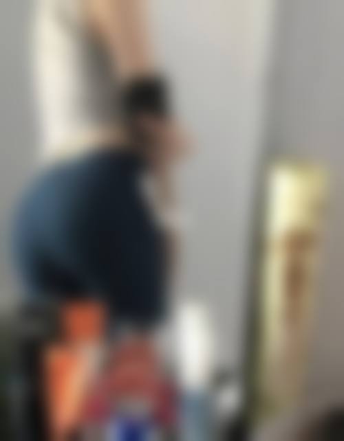 【韦金欣医生技术特点:】