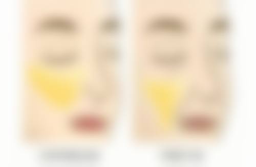 做光子嫩肤多久可以打瘦脸针？专业解答相隔时间，教你把握黄金时机实现双重美颜焕变！ 