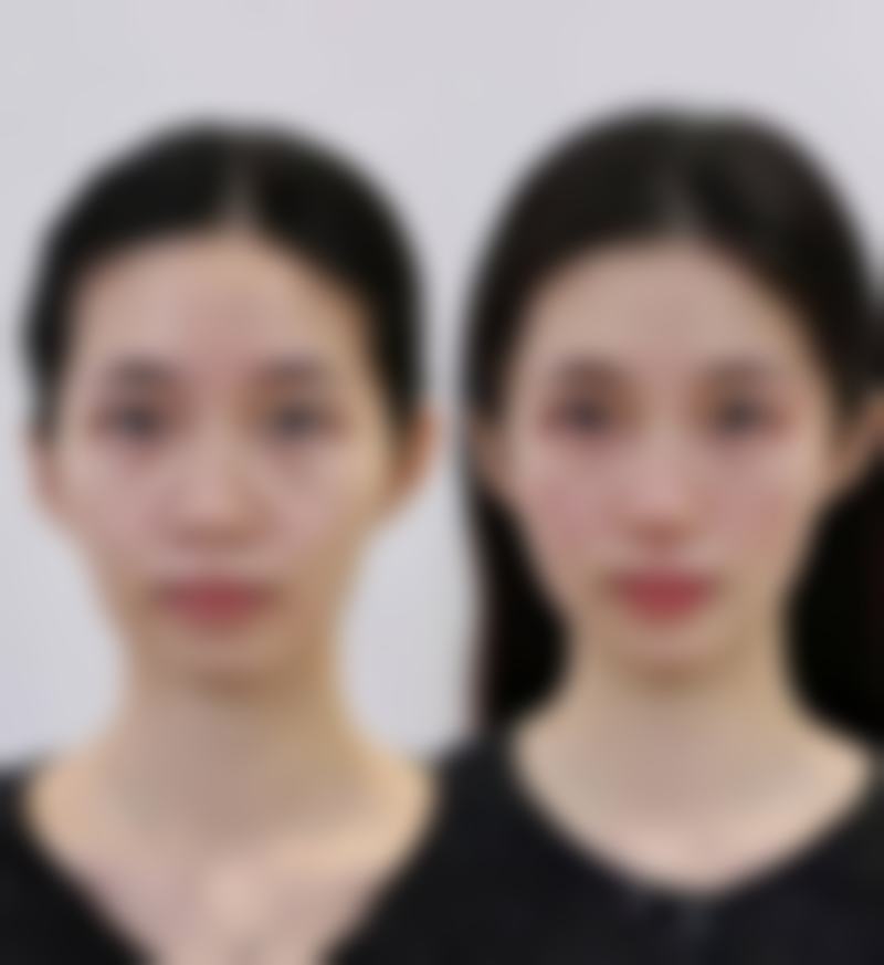 【南京懿佳整形医疗美容门诊部患者口碑评价:】