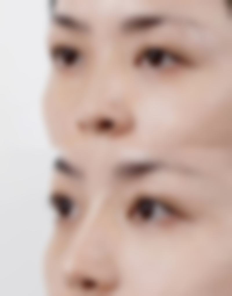 雷波美枢整形医院提供多种医疗美容项目,涵盖了整形手术、皮肤美容、注射美容等多个领域。具体有眼部整形,能让眼睛变得更加明亮有神;祛斑祛痘,帮助顾客解决皮肤瑕疵问题;身体塑形,塑造理想的身材曲线;脂肪填充,让面部更加饱满年轻。