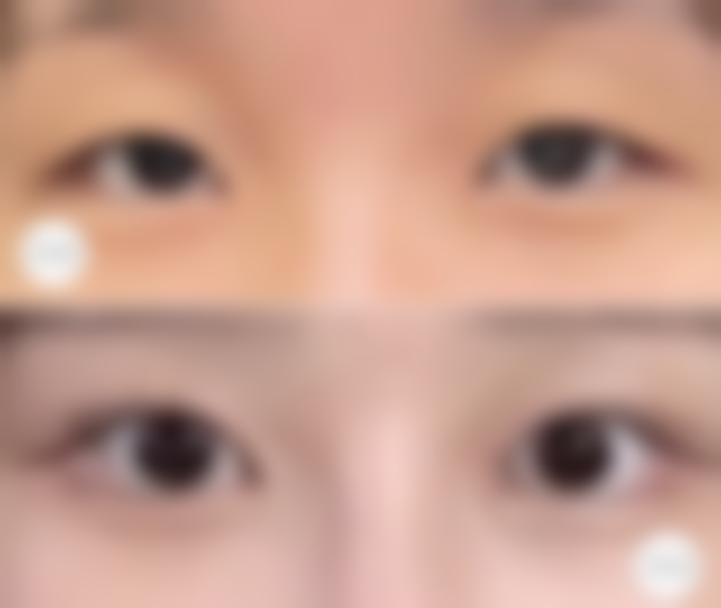 【靖边县木子艺龄整形医院诊疗设备：】