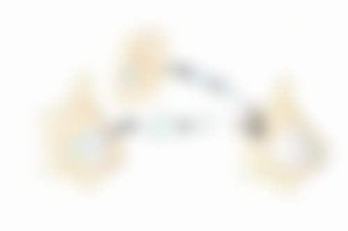 骨性凸嘴怎么矫正？掌握这5种医美矫正方法，让你告别凸嘴，拥有自信迷人笑容！ 