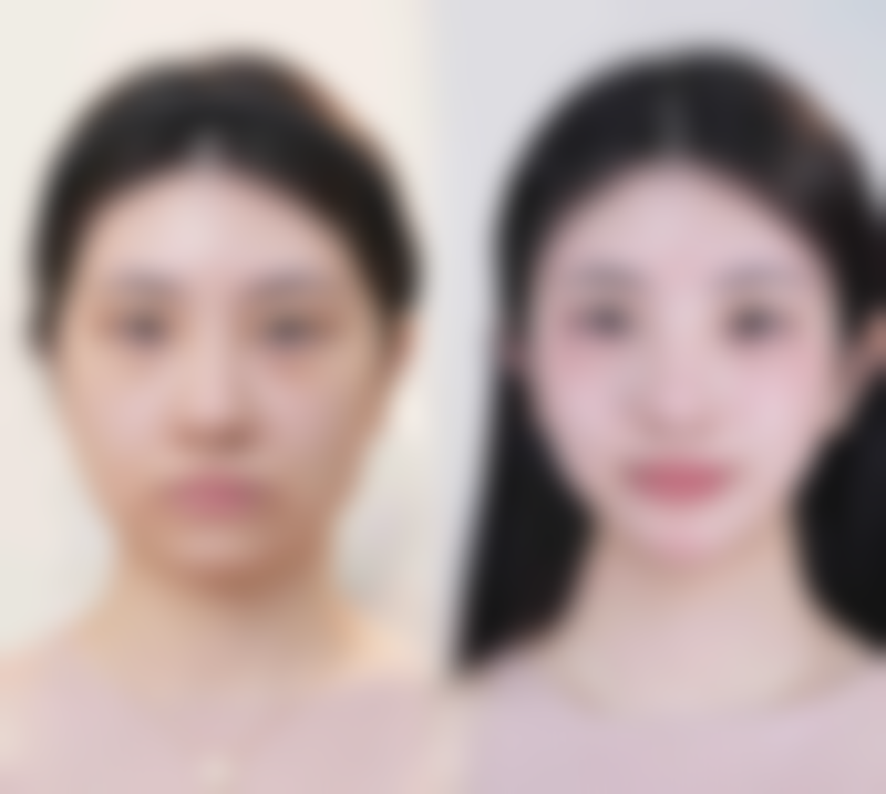【青岛华韩整形美容机构参考价格表:】