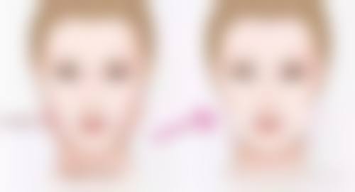 瘦脸针一边打几个点