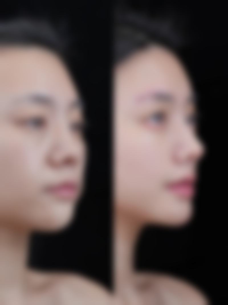 【广州真颜整形医院是正规的吗?】
