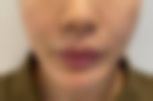 【沈阳木奈医疗美容诊所患者口碑评价:】