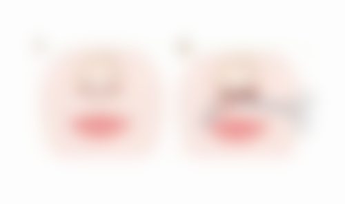 【郑州艾格眼科患者口碑评价：】