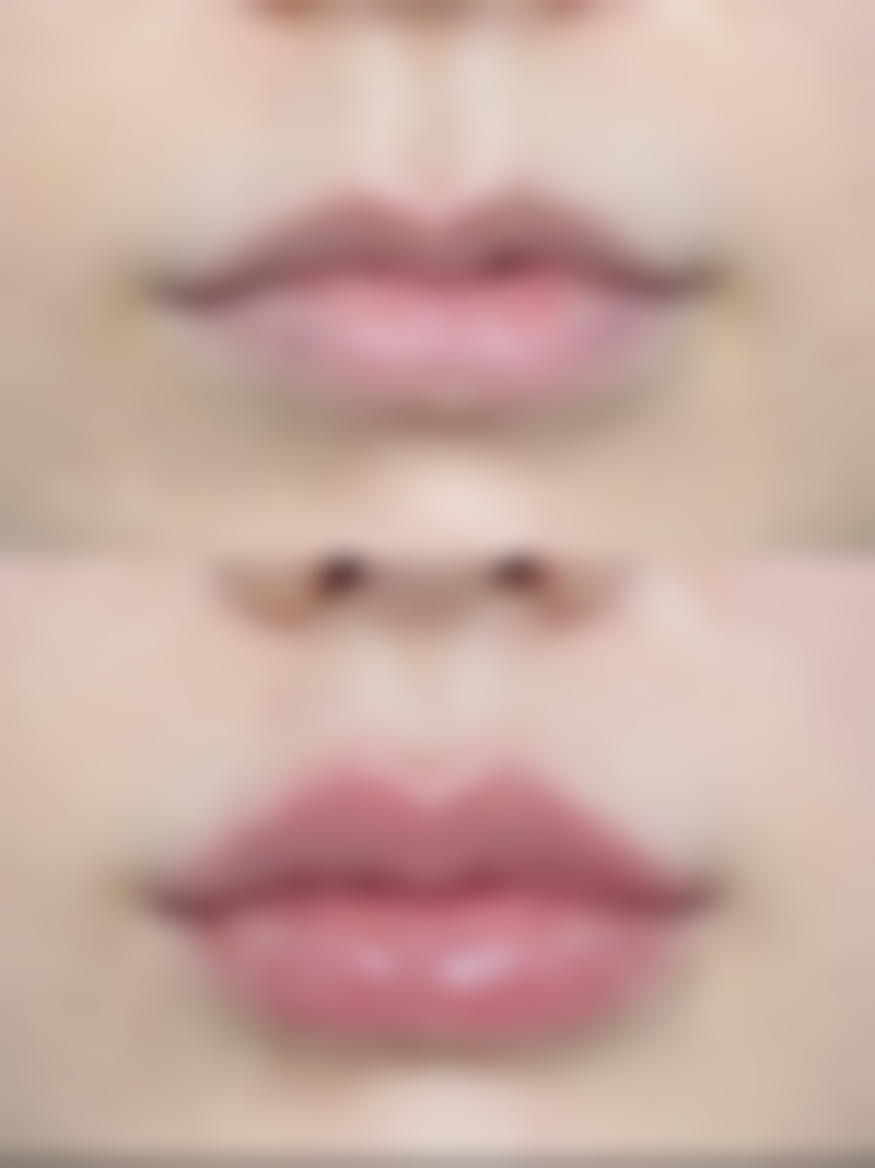 【郑州艾格眼科参考价格表：】