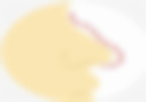 瘦脸针能维持多久