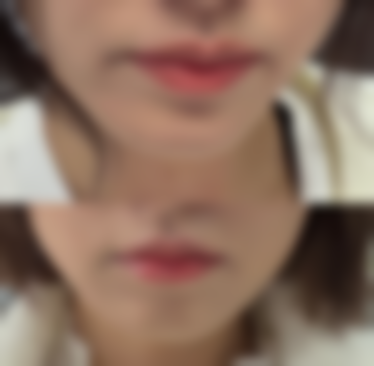 武汉美莱整形医疗美容医院参考价格表：