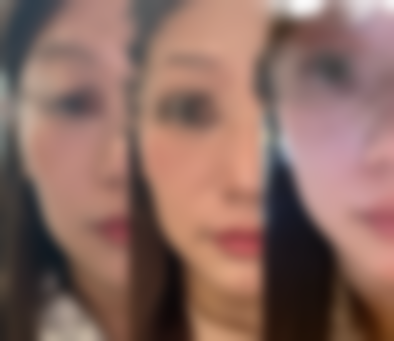 【乌鲁木齐微拉美整形医疗诊所参考价格表：】