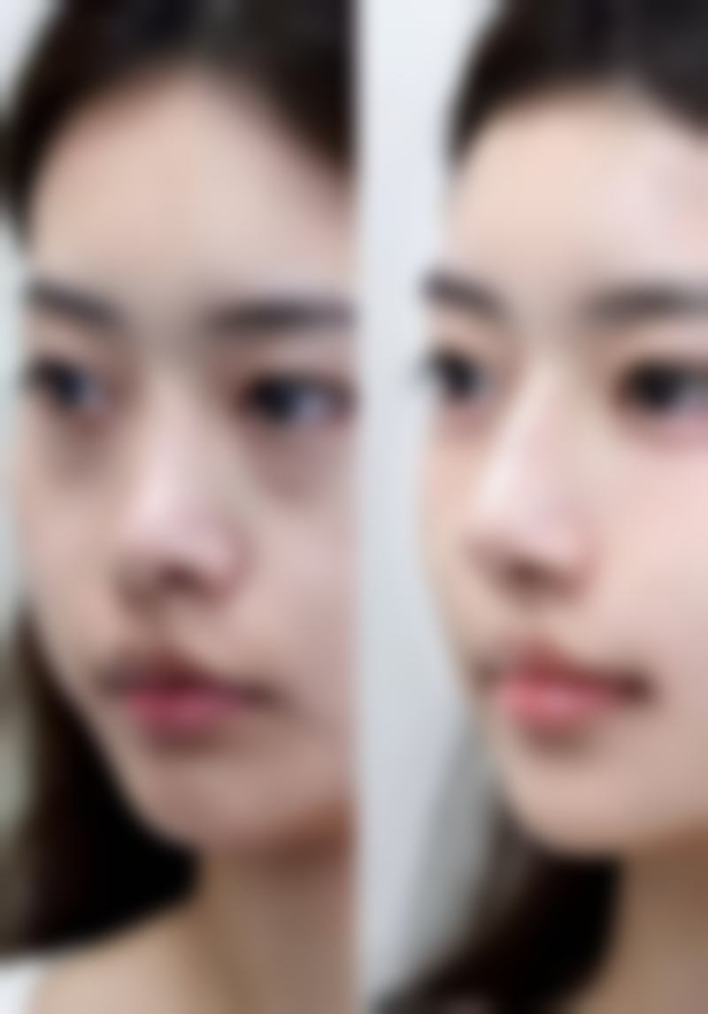 【石家庄丽华林美容服务有限公司桥西医疗美容诊所是正规的吗?】