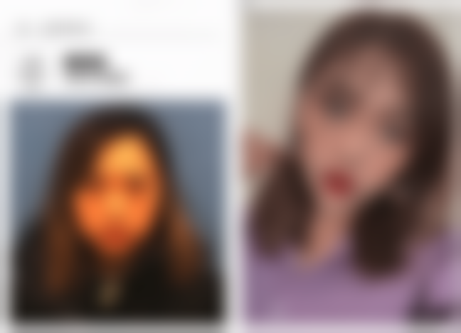 西安艺星医疗美容医院彭元做双核光祛斑值不值