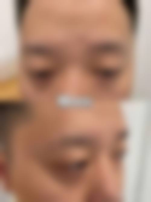 【党广轩医生擅长项目】