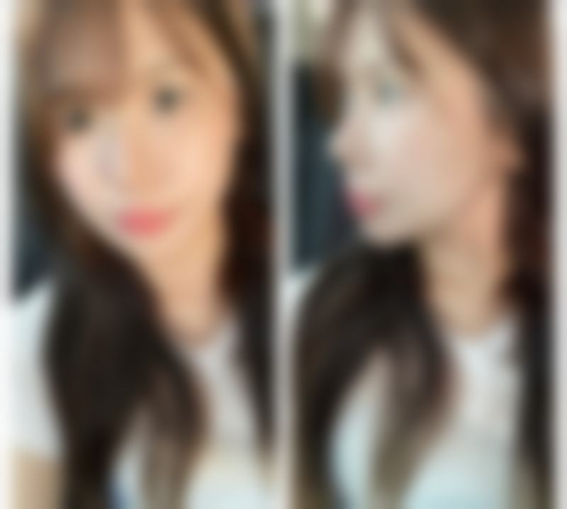 【厦门湖里今昔悦己整形医院特色项目：】