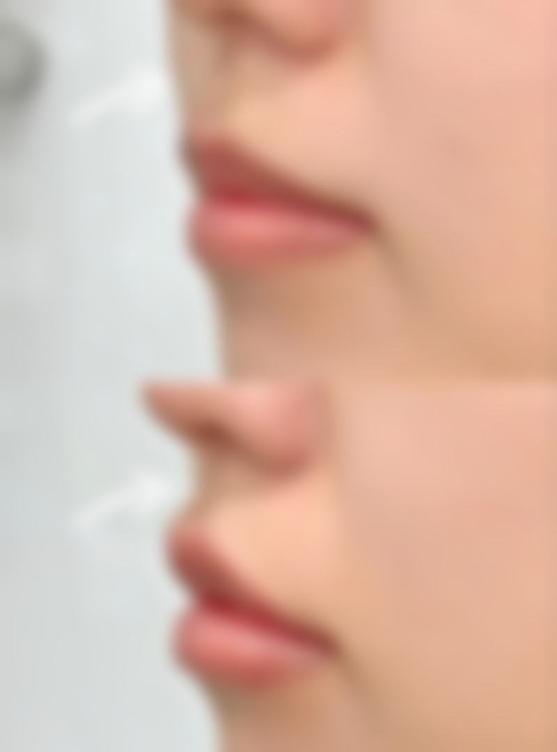 【广东省中山大学第五附院医生团队：】