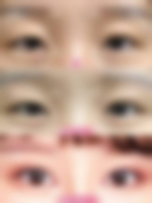 【聊城日辉整形美容医院患者口碑评价：】