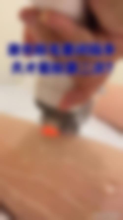 【朱炜医生口碑】
