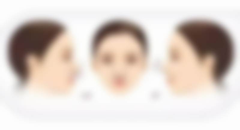 广州高尚医学美容中 心龚忠华做眼综合整形靠谱吗