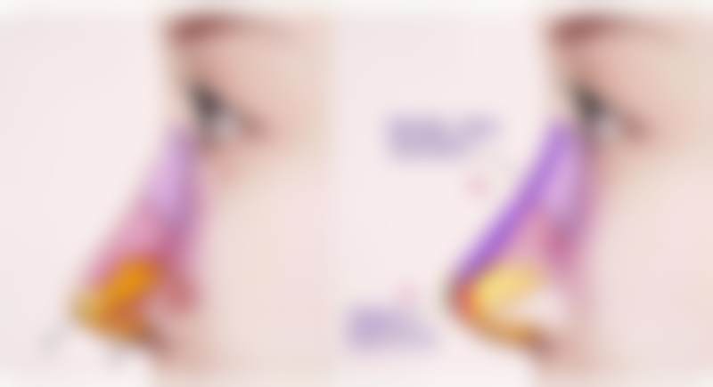 广州高尚医学美容中 心龚忠华做注射美容成效好吗