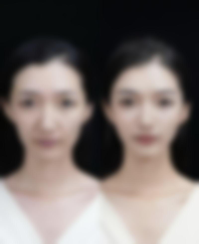 【韩国TOP整形外科怎么预约挂号?】