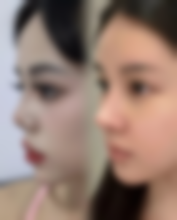 【兰州奈町洛整形美容地址：】