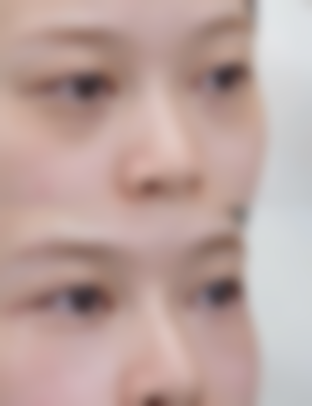 【韩国TOP整形外科参考价格表：】