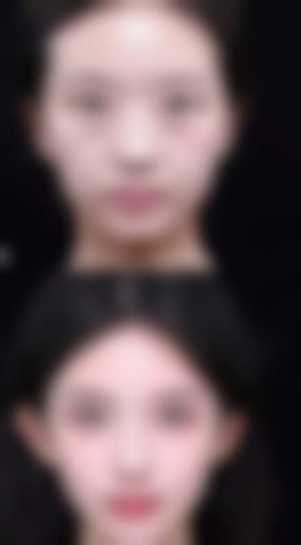 【兰州奈町洛整形美容怎么预约挂号?】