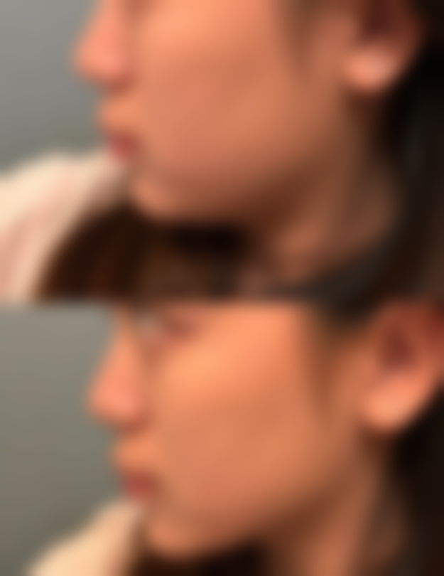 【兰州奈町洛整形美容特色项目：】