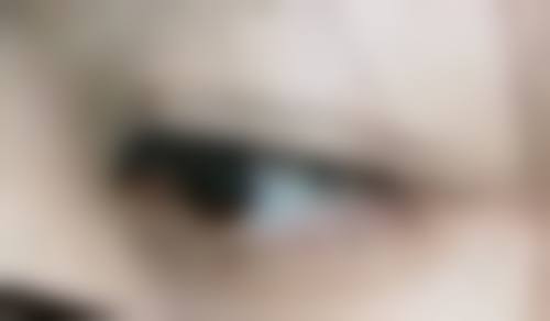 男的去打瘦脸针会不会有尴尬