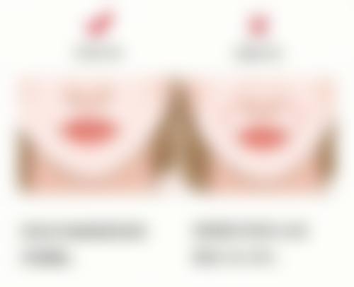 男人打瘦脸针的效果好吗？揭秘90%男士都不知的瘦脸针神奇效果，让你轻松拥有精致脸型！ 