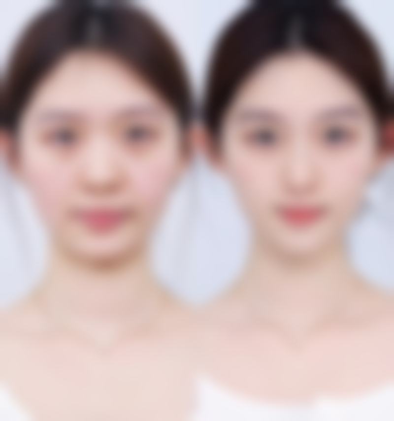 【昌吉红梅医疗美容诊所是正规的吗?】